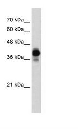 Jurkat Cell Lysate