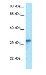 HNRNPC / HNRNP C antibody Western Blot of Mouse Lung.