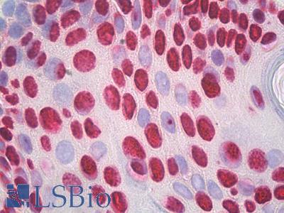 Anti-HNRNPC / HNRNP C antibody IHC staining of human skin, epidermis. Immunohistochemistry of formalin-fixed, paraffin-embedded tissue after heat-induced antigen retrieval.