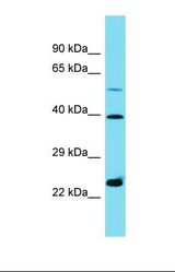 Western blot of U937. HSD11B1L antibody dilution 1.0 ug/ml.