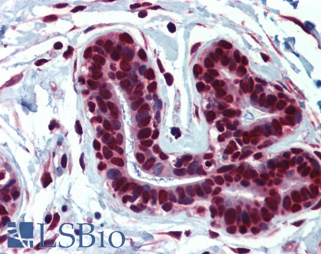 Anti-HNRNPC / HNRPC antibody IHC of human breast. Immunohistochemistry of formalin-fixed, paraffin-embedded tissue after heat-induced antigen retrieval. Antibody LS-B5705 concentration 5 ug/ml.