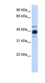 HNRNPC / HNRPC antibody LS-B5705 Western blot of Transfected 293T cell lysate.