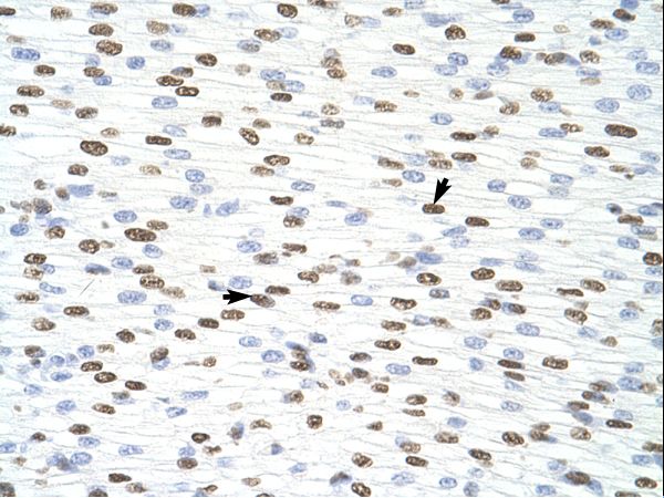 HNRNPD / AUF1 antibody LS-C31750 was used in IHC to stain formalin-fixed, paraffin-embedded human heart.