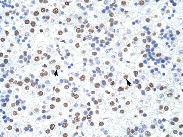 HNRNPD / AUF1 antibody LS-C31750 was used in IHC to stain formalin-fixed, paraffin-embedded human liver.