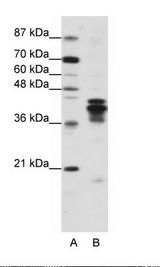 A: Marker, B: Jurkat Cell Lysate