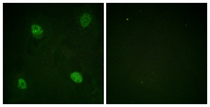 Immunofluorescence of HeLa cells, using hnRPD (Phospho-Ser83) Antibody. The sample on the right was incubated with synthetic peptide.