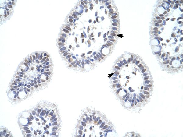 HNRNPD / AUF1 antibody LS-C31751 was used in IHC to stain formalin-fixed, paraffin-embedded human intestine.