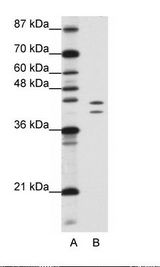 A: Marker, B: Jurkat Cell Lysate