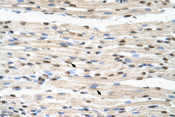 HNRPDL antibody LS-C31582 IHC of formalin-fixed, paraffin-embedded human Muscle. Positive label: Skeletal muscle cells indicated with arrows. Antibody concentration 4-8 ug/ml. Magnification 400X.