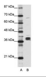 A: Marker, B: Daudi Cell Lysate