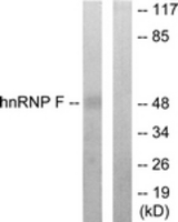 Western blot of extracts from HepG2 cells, using hnRNP F Antibody. The lane on the right is treated with the synthesized peptide.