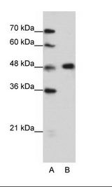 A: Marker, B: HepG2 Cell Lysate