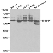 Western blot analysis of extracts of various cell lines, using HNRNPF antibody.