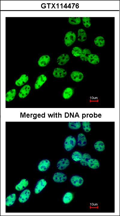 Immunofluorescence of paraformaldehyde-fixed A431 using hnRNP F antibody at 1:200 dilution.