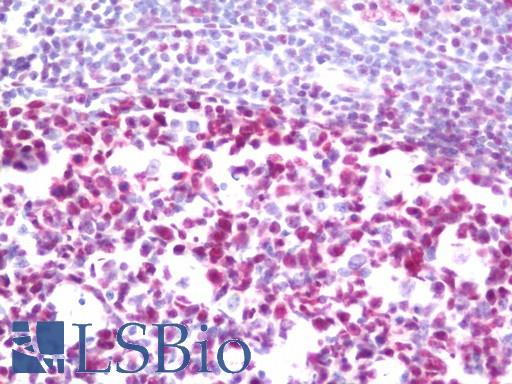 Anti-HNRNPH1 / HnRNP H antibody IHC staining of human tonsil. Immunohistochemistry of formalin-fixed, paraffin-embedded tissue after heat-induced antigen retrieval. Antibody LS-B11037 dilution 1:100.