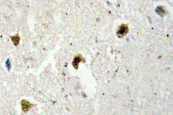 IHC of hnRNP H (R192)pAb in paraffin-embedded human brain tissue.