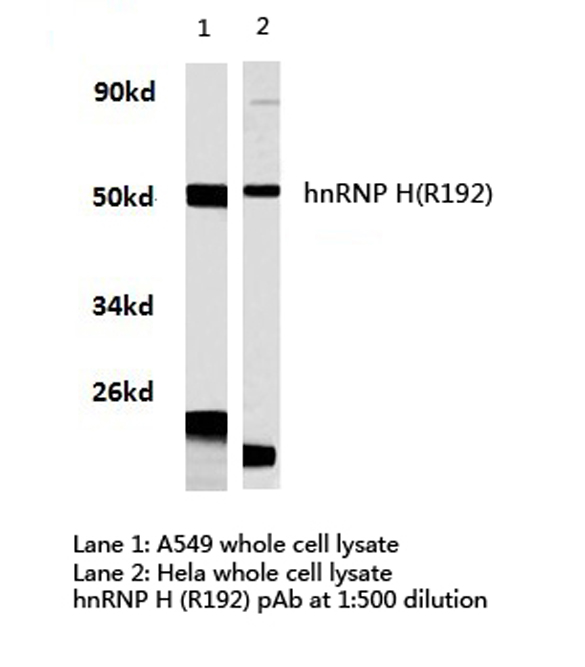 Western blot of hnRNP H (R192) pAb in extracts from HeLa and A549 cells.