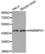 Western blot analysis of extracts of various cell lines, using HNRNPH1 antibody.