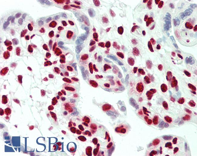 Anti-HNRNPH1 / HnRNP H antibody IHC staining of human placenta. Immunohistochemistry of formalin-fixed, paraffin-embedded tissue after heat-induced antigen retrieval.