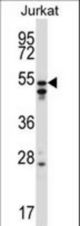 HNRNPH2 Antibody western blot of Jurkat cell line lysates (35 ug/lane). The HNRNPH2 antibody detected the HNRNPH2 protein (arrow).