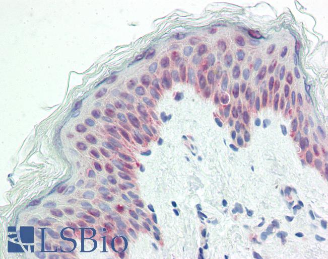 Anti-HNRNPH2 / hnRNP H2 antibody IHC staining of human skin. Immunohistochemistry of formalin-fixed, paraffin-embedded tissue after heat-induced antigen retrieval. Antibody LS-B9926 concentration 10 ug/ml.