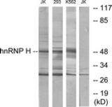 Western blot of extracts from Jurkat/293/K562 cells, using hnRNP H Antibody. The lane on the right is treated with the synthesized peptide.