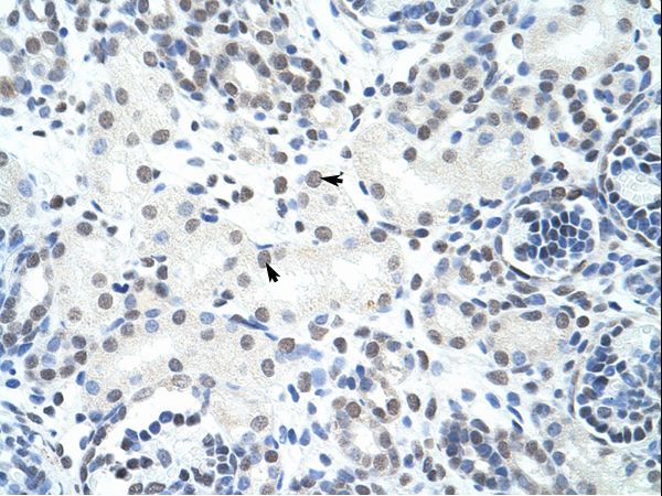 HNRNPH3 / HNRPH3 antibody LS-C31565 was used in IHC to stain formalin-fixed, paraffin-embedded human kidney.