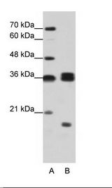 A: Marker, B: Rap Cell Lysate