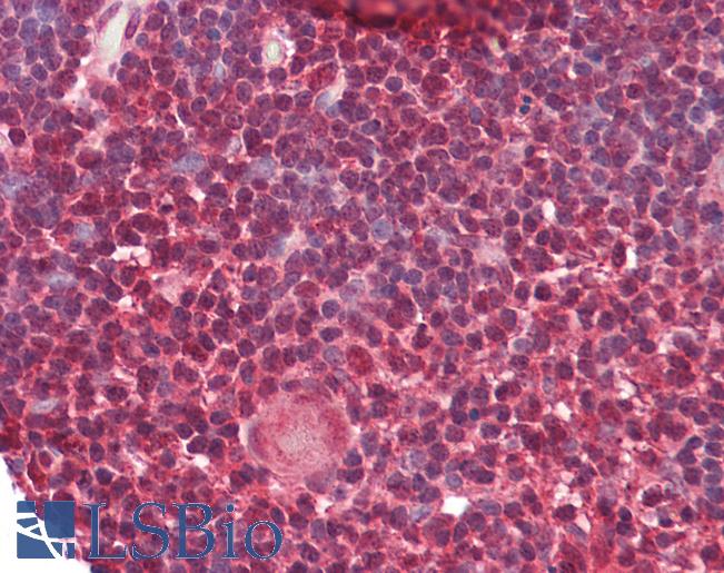 Anti-HnRNP K antibody IHC of human thymus. Immunohistochemistry of formalin-fixed, paraffin-embedded tissue after heat-induced antigen retrieval. Antibody LS-B7996 dilution 5-10 ug/ml.
