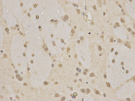 Immunohistochemistry of paraffin-embedded rat liver using HNRNPK antibody at dilution of 1:200 (400x lens).