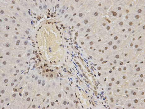 Immunohistochemistry of paraffin-embedded rat brain using HNRNPK antibody at dilution of 1:200 (400x lens).