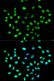 Immunofluorescence analysis of MCF7 cell using HNRNPK antibody. Blue: DAPI for nuclear staining.