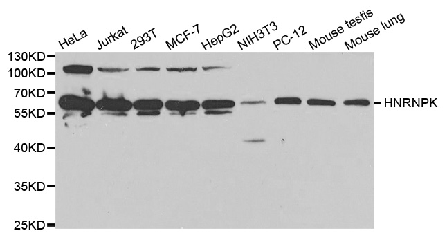 Western blot analysis of extracts of various cell lines, using HNRNPK antibody.