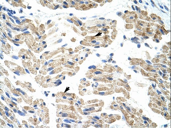 HNRNPK / hnRNP K antibody LS-C31647 was used in IHC to stain formalin-fixed, paraffin-embedded human muscle.