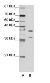 A: Marker, B: HepG2 Cell Lysate
