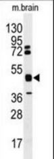 Western blot of anti-HNRPK Antibody in mouse brain tissue lysates (35 ug/lane). HNRPK(arrow) was detected using the purified antibody.