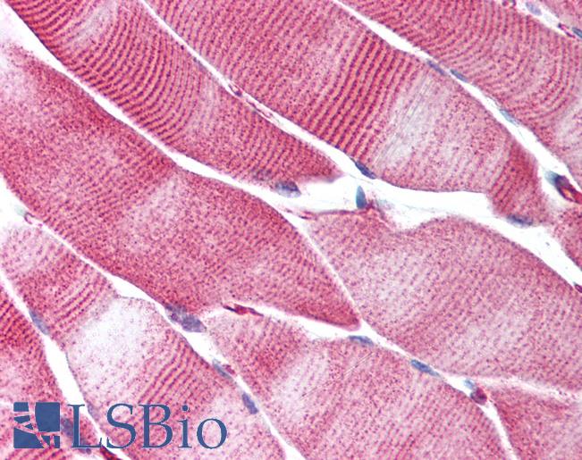 Anti-STIM1 antibody IHC of human skeletal muscle. Immunohistochemistry of formalin-fixed, paraffin-embedded tissue after heat-induced antigen retrieval. Antibody LS-B1408 concentration 5 ug/ml.