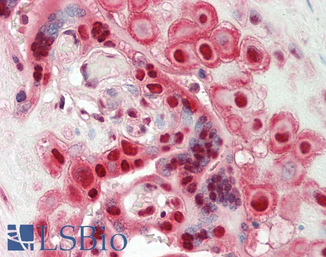 Human Placenta: Formalin-Fixed, Paraffin-Embedded (FFPE)