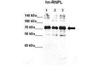 Western blot analysis using Anti-HNRNPL / hnRNP L Antibody (aa82-131) at 1:4000 dilution (20ug loaded per lane). Lane 1: Hela S3 lysate. Lane 2: MCF7 lysate. Lane 3: K562 lysate. 