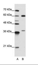 A: Marker, B: Jurkat Cell Lysate