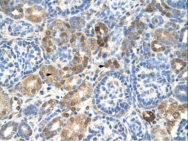 HNRNPL / hnRNP L antibody LS-C31786 was used in IHC to stain formalin-fixed, paraffin-embedded human kidney.