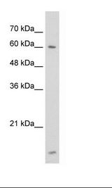 Jurkat Cell Lysate