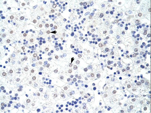 HNRNPL / hnRNP L antibody LS-C31706 was used in IHC to stain formalin-fixed, paraffin-embedded human liver.