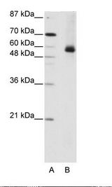 A: Marker, B: HepG2 Cell Lysate