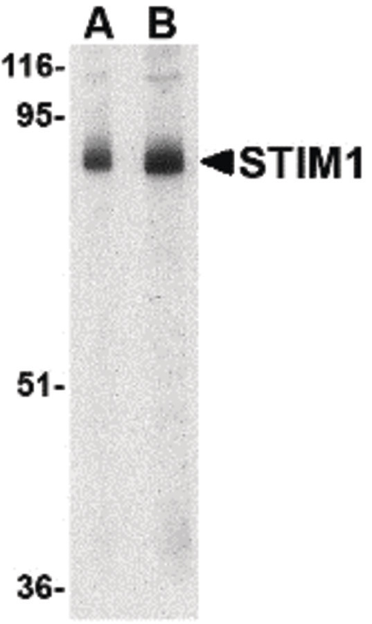 Western blot of STIM1 in mouse thymus tissue lysate with STIM1 antibody at (A) 1 and (B) 2 ug/ml.