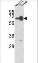 Western blot of HNRPL Antibody in HepG2, Jurkat cell line lysates (35 ug/lane). HNRPL (arrow) was detected using the purified antibody.