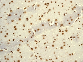 IHC of paraffin-embedded human brain tissue using anti-HNRPUL1 antibody (cat# 2353-1).