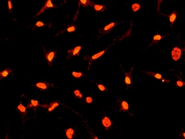 Immunofluorescent staining of HeLa cells using anti-HNRPUL1 antibody (cat# 2353-1).