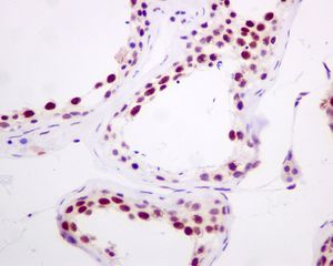 IHC of paraffin-embedded human testis tissue using anti-HNRNPUL1 / HNRPUL1 antibody.