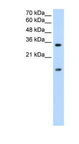 HNRNPUL1 / HNRPUL1 antibody LS-B1537 Western blot of Jurkat lysate.